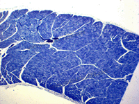 Skeletal muscle T.S. and L.S