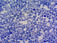 Human blood (HE)